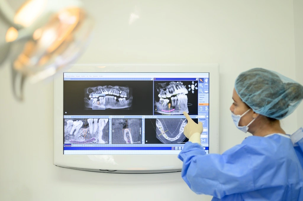 dental implant procedures dentist dental implant x-ray