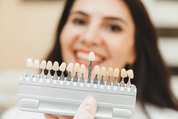 Veneers can cover discoloration or any damage your teeth have.