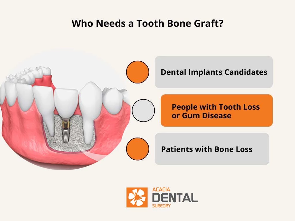 Dental Bone Graft What You Need to Know — Acacia Dental