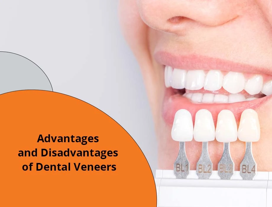 dental veneers pros and cons