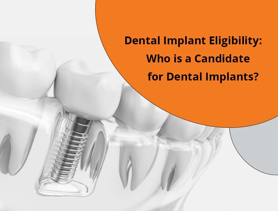 dental-implant-eligibility-who-is-a-good-candidate-for-dental-implants