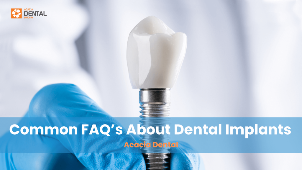 Common FAQs About Dental Implants in Darwin